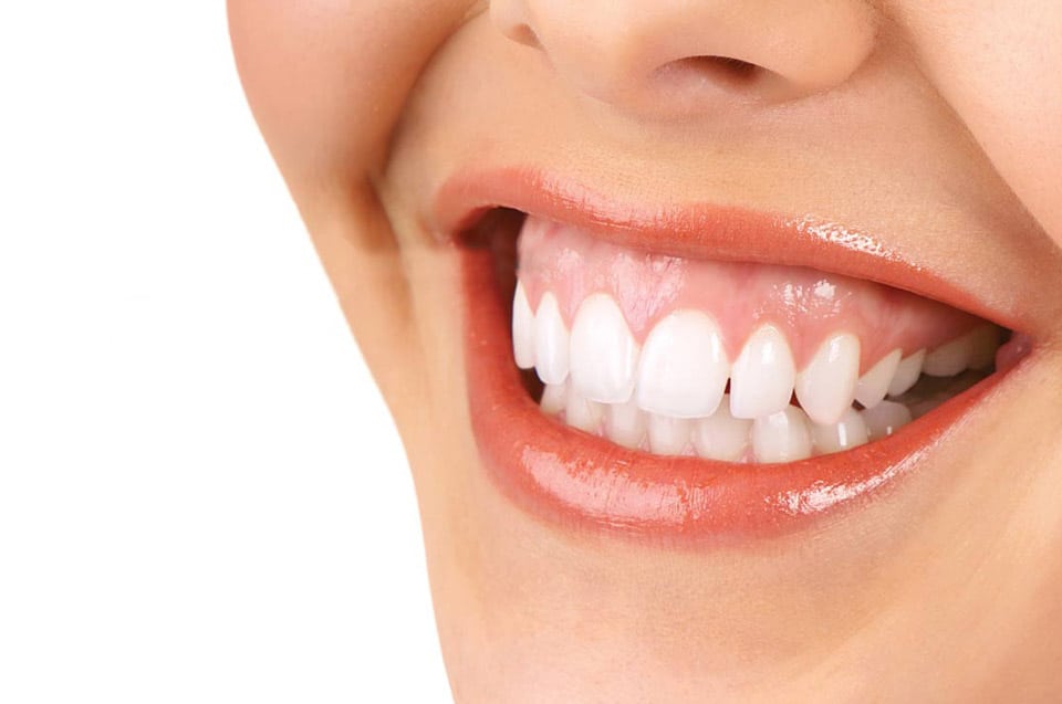 Dental Contouring for Gummy Smiles: Reshaping Your Gumline in Norfolk, MA